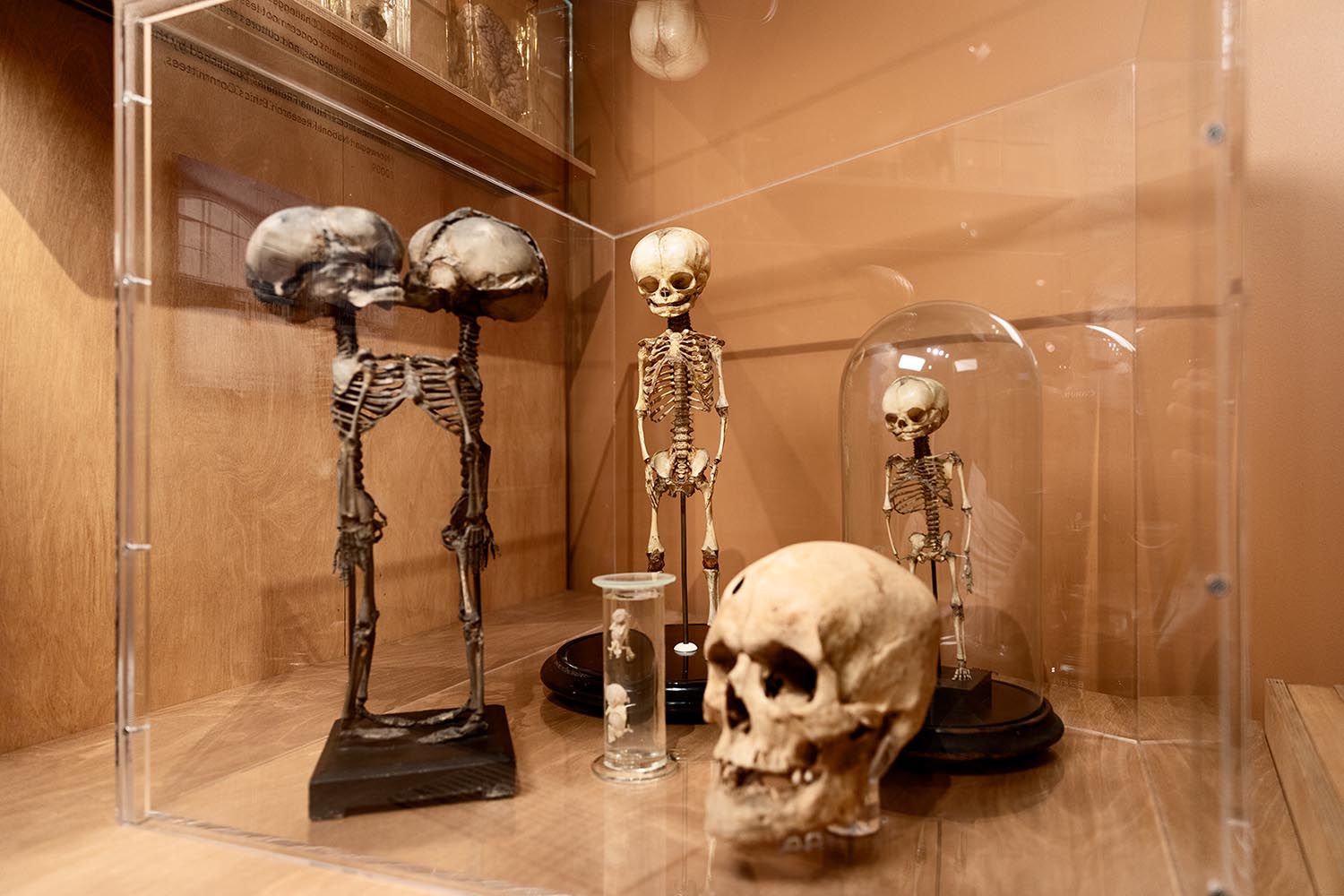 Bilde av mange små skjeletter tilhørende barn.